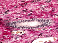 FUCHSIN ACID (C.I. 42685) FOR MICROSCOPY